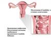 Vattnig flytning under graviditeten i olika stadier: normal eller patologisk?