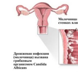 Vizes váladékozás a terhesség alatt különböző szakaszokban: normális vagy kóros?